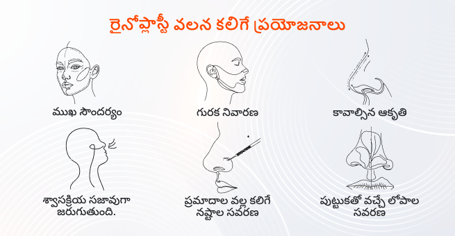 rhinoplasty