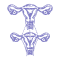 Uterus Transplant