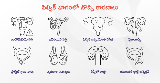 pelvic-pain-body