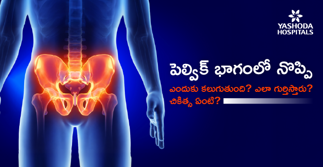 pelvic-pain-main