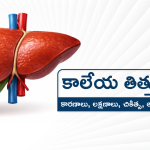 liver-cysts-telugu-main