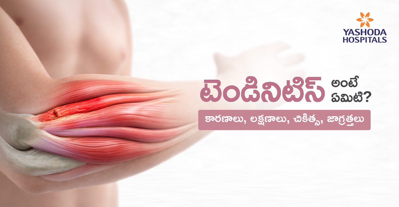tendinitis-telugu