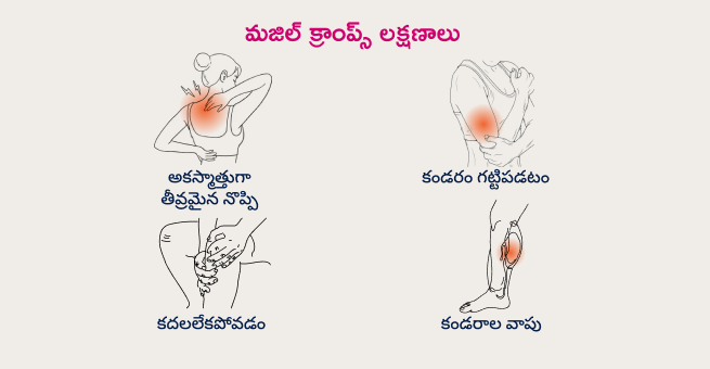 muscle cramps-symptoms