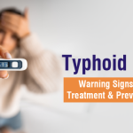 typhoid-fever