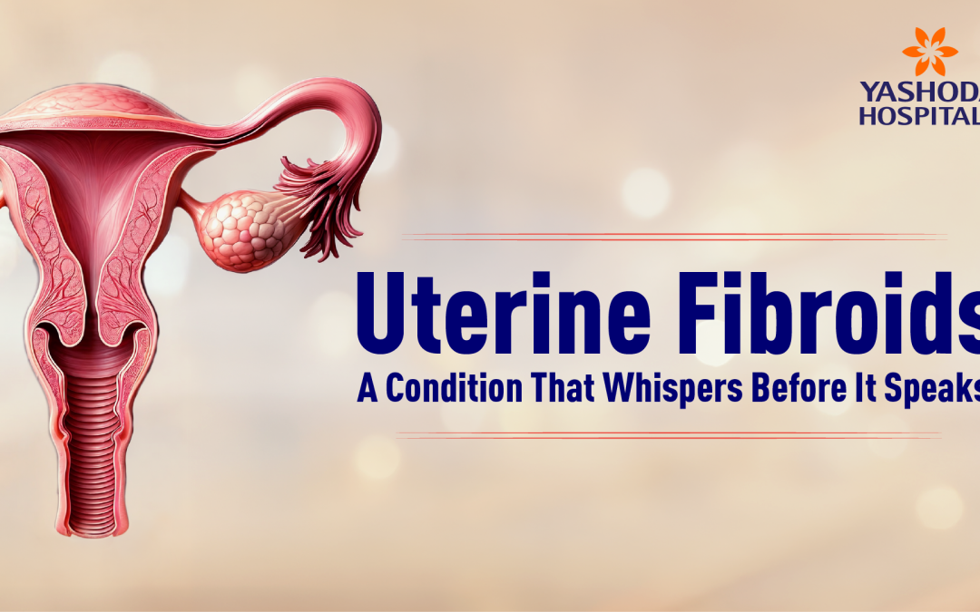 Uterine Fibroids: Symptoms, Causes, Diagnosis & Treatment Options