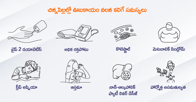 childhood-obesity-causes