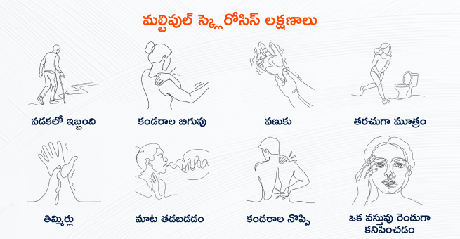 Brain-signals symptoms