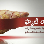 Fatty-Liver