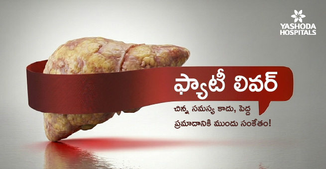 Fatty-Liver