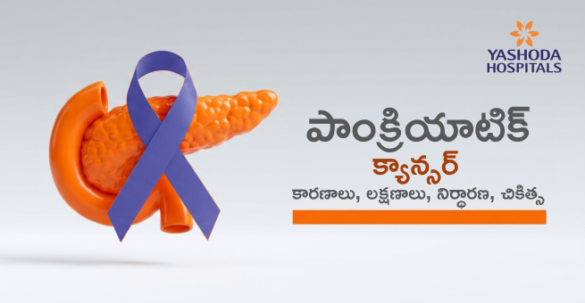Pancreatic-Cancer