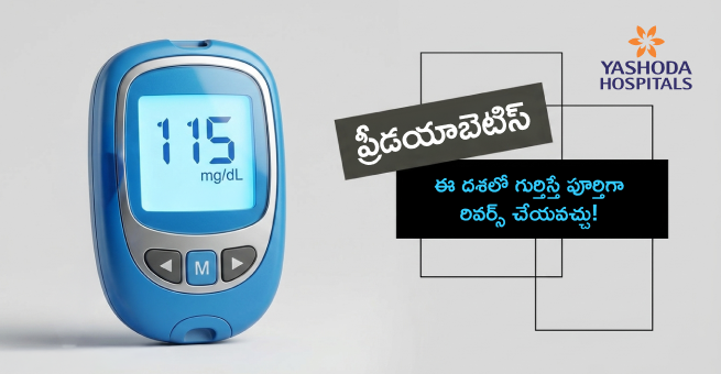 Prediabetes