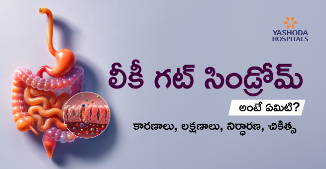 లీకీ గట్ సిండ్రోమ్ అంటే ఏమిటి? కారణాలు, లక్షణాలు, నిర్ధారణ, చికిత్స