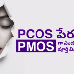 PCOS-to-PMOS