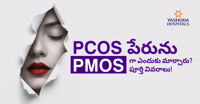 PMOS అంటే ఏమిటి? PCOS పేరును PMOS గా ఎందుకు మార్చారు? పూర్తి వివరాలు!