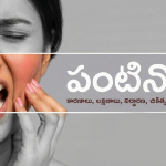 Teeth-Pain