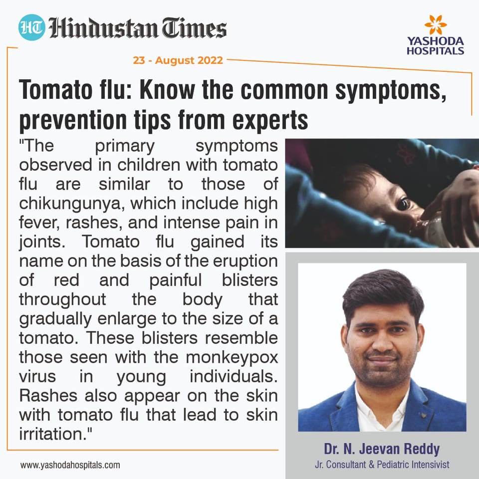 The primary symptoms observed in children with tomato flu are similar to those of chikungunya