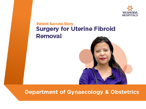 Surgery for Uterine Fibroid Removal