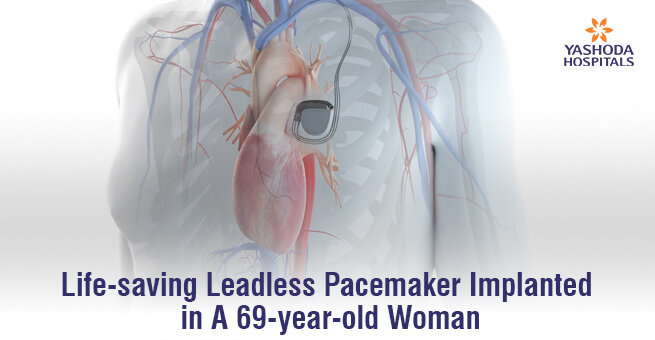A leadless pacemaker