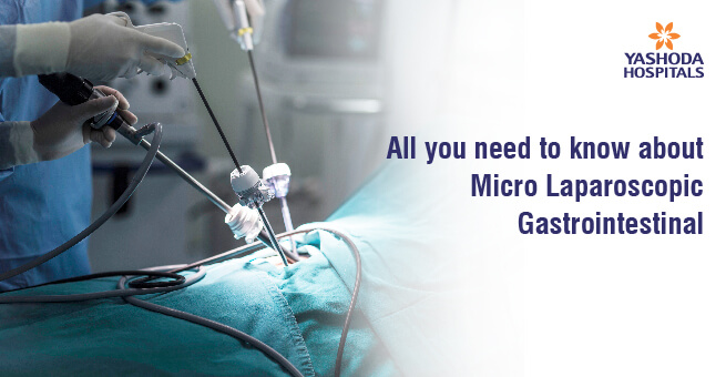 All-you-need-to-know-about-Micro-Laparoscopic-Gastrointestinal