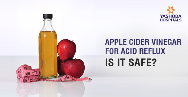 Apple Cider Vinegar for Acid Reflux
