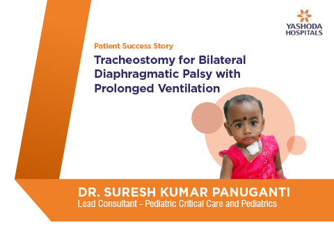 Tracheostomy for Bilateral Diaphragmatic Palsy with Prolonged Ventilation