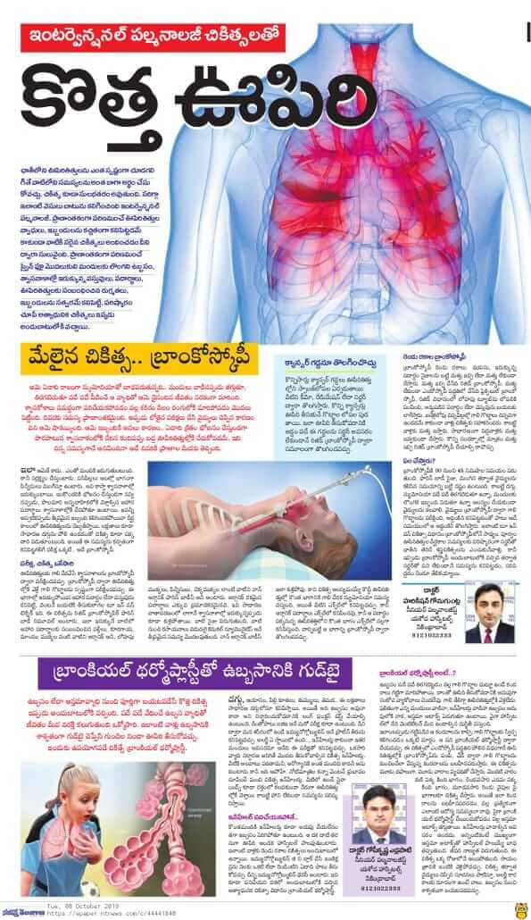 Bronchial Thermoplasty for Asthma - Dr Harikishan G Pulmonologist