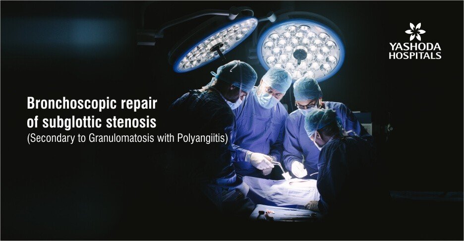 Bronchoscopic repair of subglottic stenosis