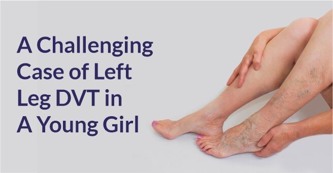 A Challenging Case of Left Leg DVT in A Young Girl