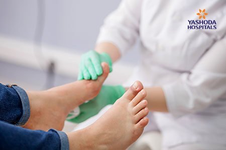 Diabetic Charcot Foot: Diagnosis, Prevention and Treatment
