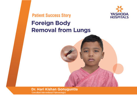 Foreign Body Removal treated by Dr. Hari Kishan Gonuguntla