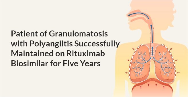 Granulomatosis with Polyangiitis Successfully Maintained on Rituximab Biosimilar