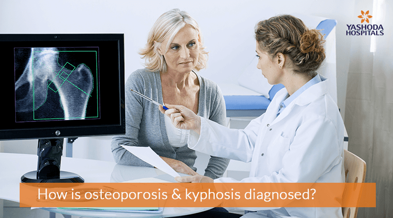 How is osteoporosis & kyphosis diagnosed