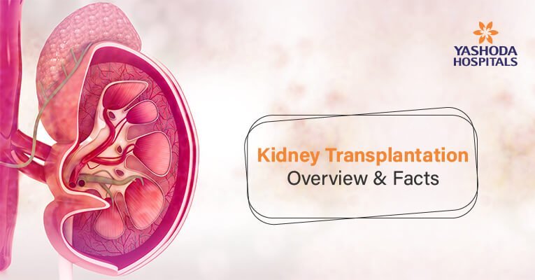 Diet Chart After Kidney Transplant In Hindi