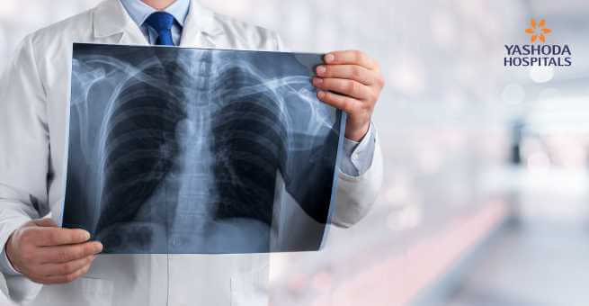 Lung Radiography