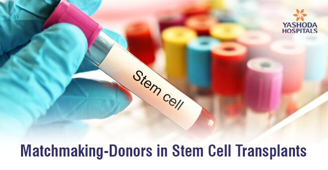 Matchmaking-Donors in Stem Cell Transplants