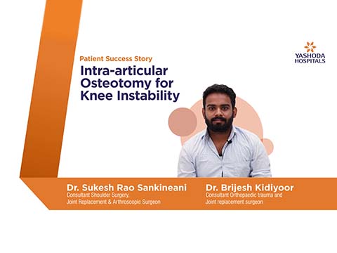 Articular Osteotomy for Knee Instability