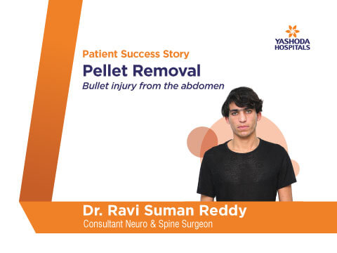 Pellet Removal Dr. Ravi Suman Reddy
