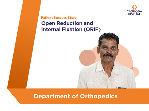 Open Reduction and Internal Fixation