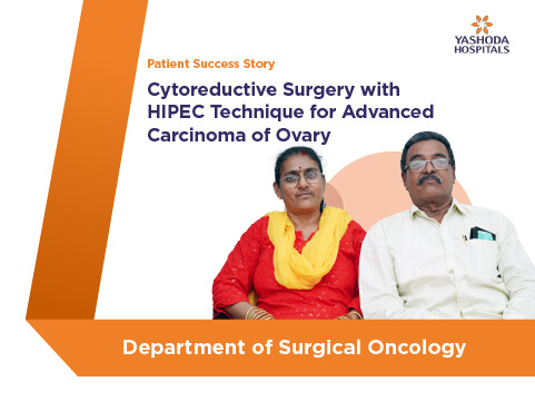 Advanced Carcinoma Ovary