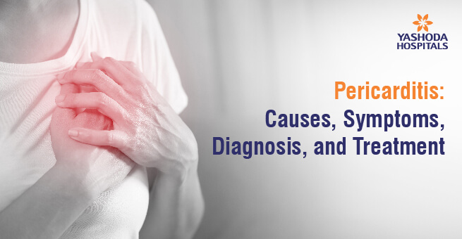 Pericarditis: Causes, Symptoms, Diagnosis, and Treatment