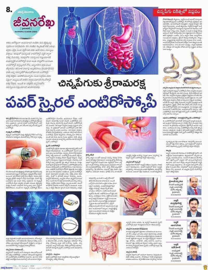 Power spiral enteroscopy is game changing technology in treating small intestine diseases