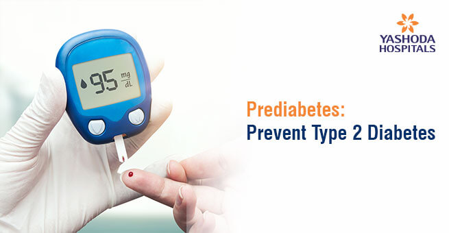 Prediabetes: Prevent Type 2 Diabetes