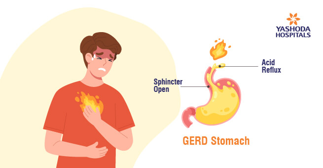 Preventive Care in Gastroenterology2
