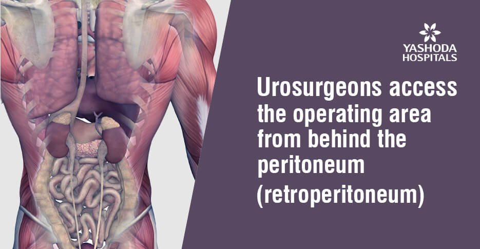 Retroperitoneoscopic surgery