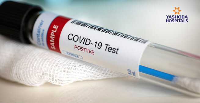 Testing presence coronavirus tube