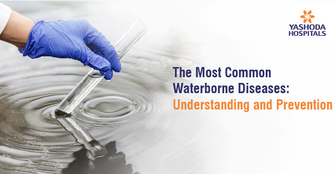 The Most Common Waterborne Diseases: Understanding and Prevention
