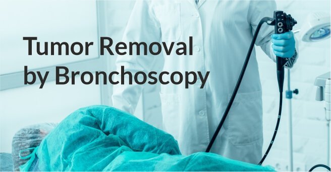 Tumor Removal by Bronchoscopy Case-1