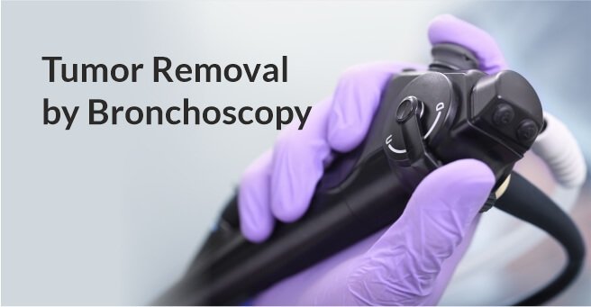 Tumor Removal by Bronchoscopy Case-2