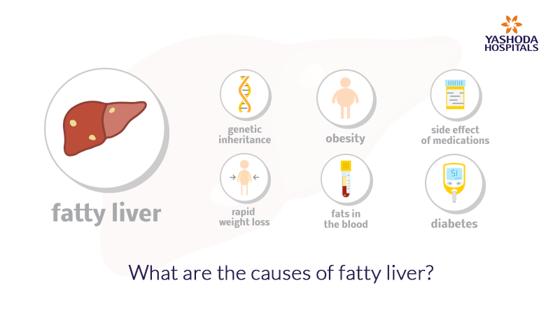 What are the causes of fatty liver