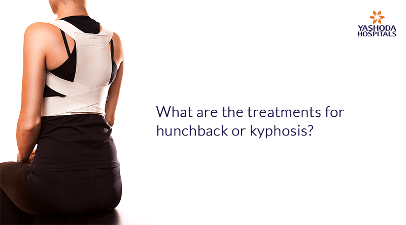 What are the treatments for hunchback or kyphosis